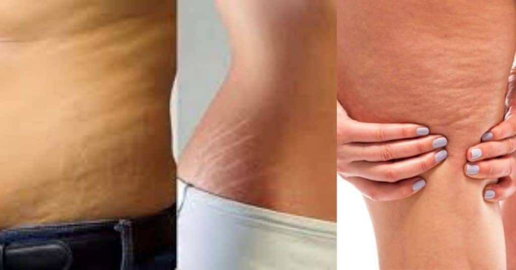 goya anticellulite thermo gel prezzo